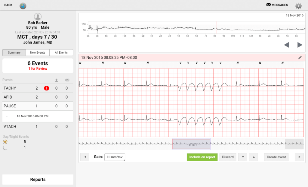 Medical cloud app interface: Patient ECG data profiling and visualization